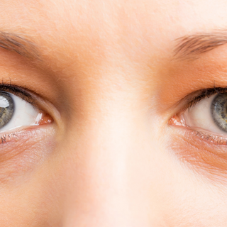 How to Hack Dark Undereye Circles: Our Tips and Tricks for Instant Brightening