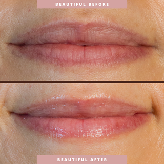 Hydrating Lip Treatment