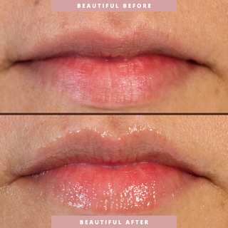 Hydrating Lip Treatment