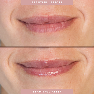 Hydrating Lip Treatment