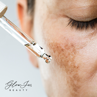 Minimizing Melasma: Our Tips and Product Picks for Treatment