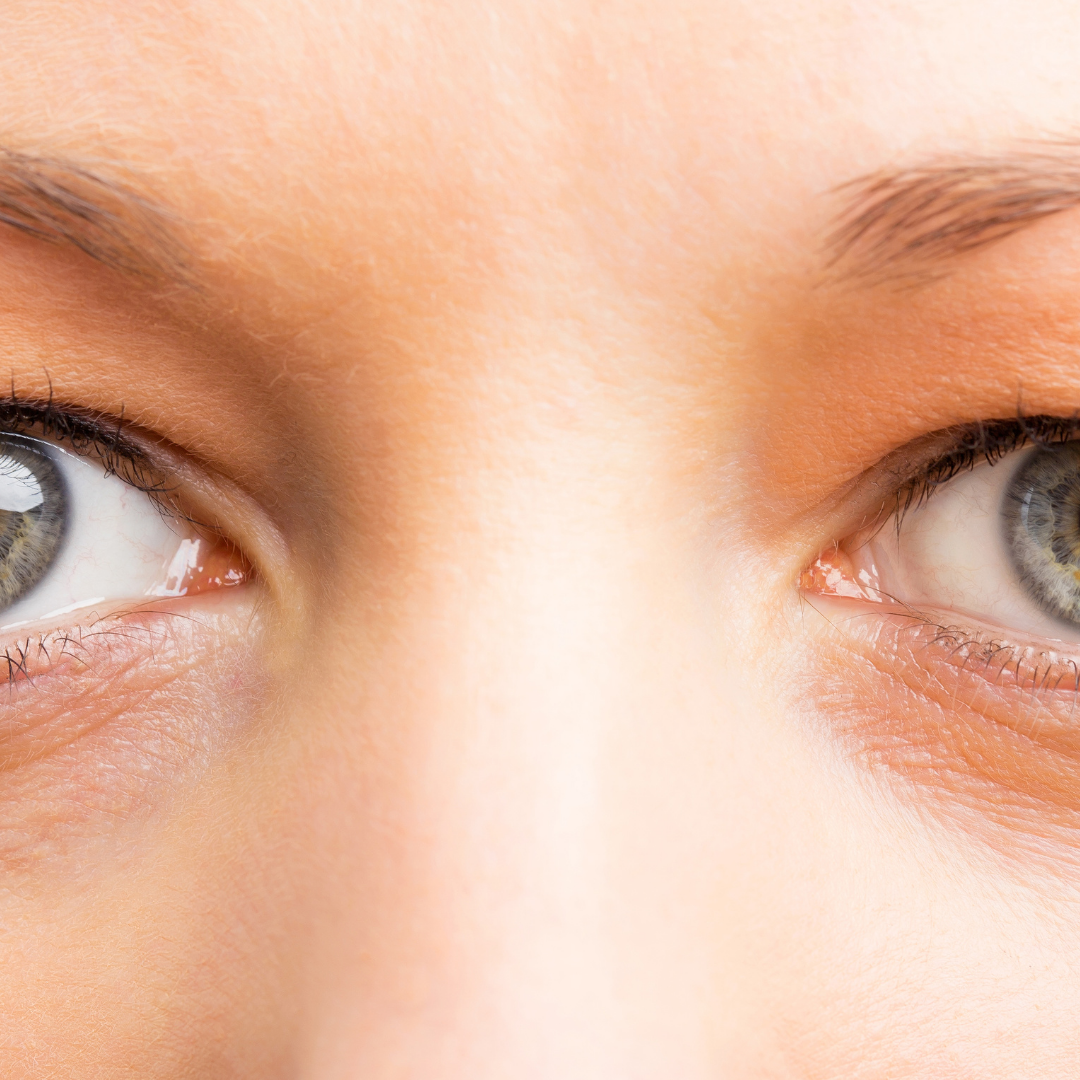 How to Hack Dark Undereye Circles: Our Tips and Tricks for Instant Brightening