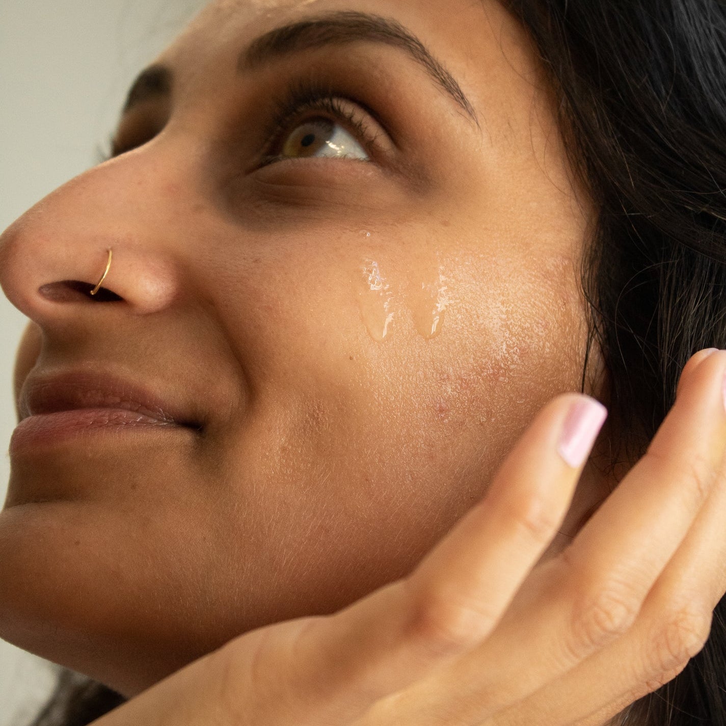 Hyperpigmentation