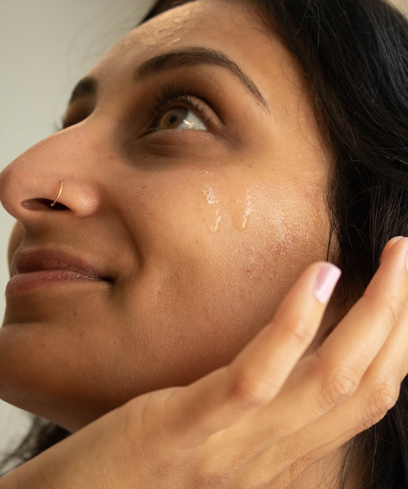 Hyperpigmentation
