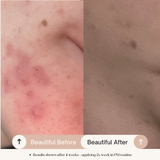 Clarifying Toner