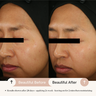 7.6% AHA Leave On Exfoliant