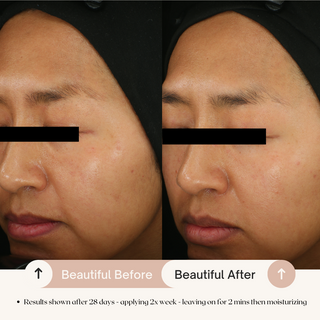 7% AHA Overnight Facial Peel