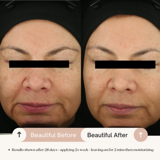 7.6% AHA Leave On Exfoliant