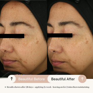7.6% AHA Leave On Exfoliant