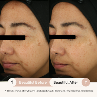 7% AHA Overnight Facial Peel