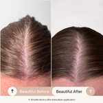 Glow Jar Beauty customer before and after scalp serum
