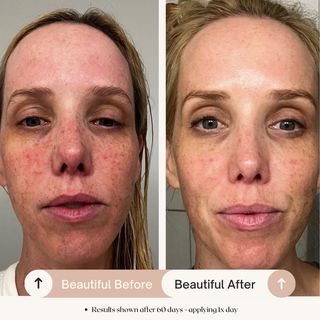 Hydrating Radiance Serum