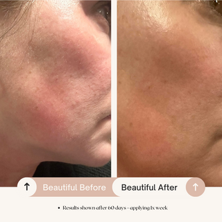 7.6% AHA Leave On Exfoliant