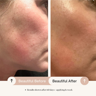 7% AHA Overnight Facial Peel