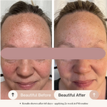 Before and After AHA Exfoliant