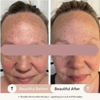 7% AHA Overnight Facial Peel