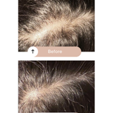 Healthy Scalp & Fullness Serum