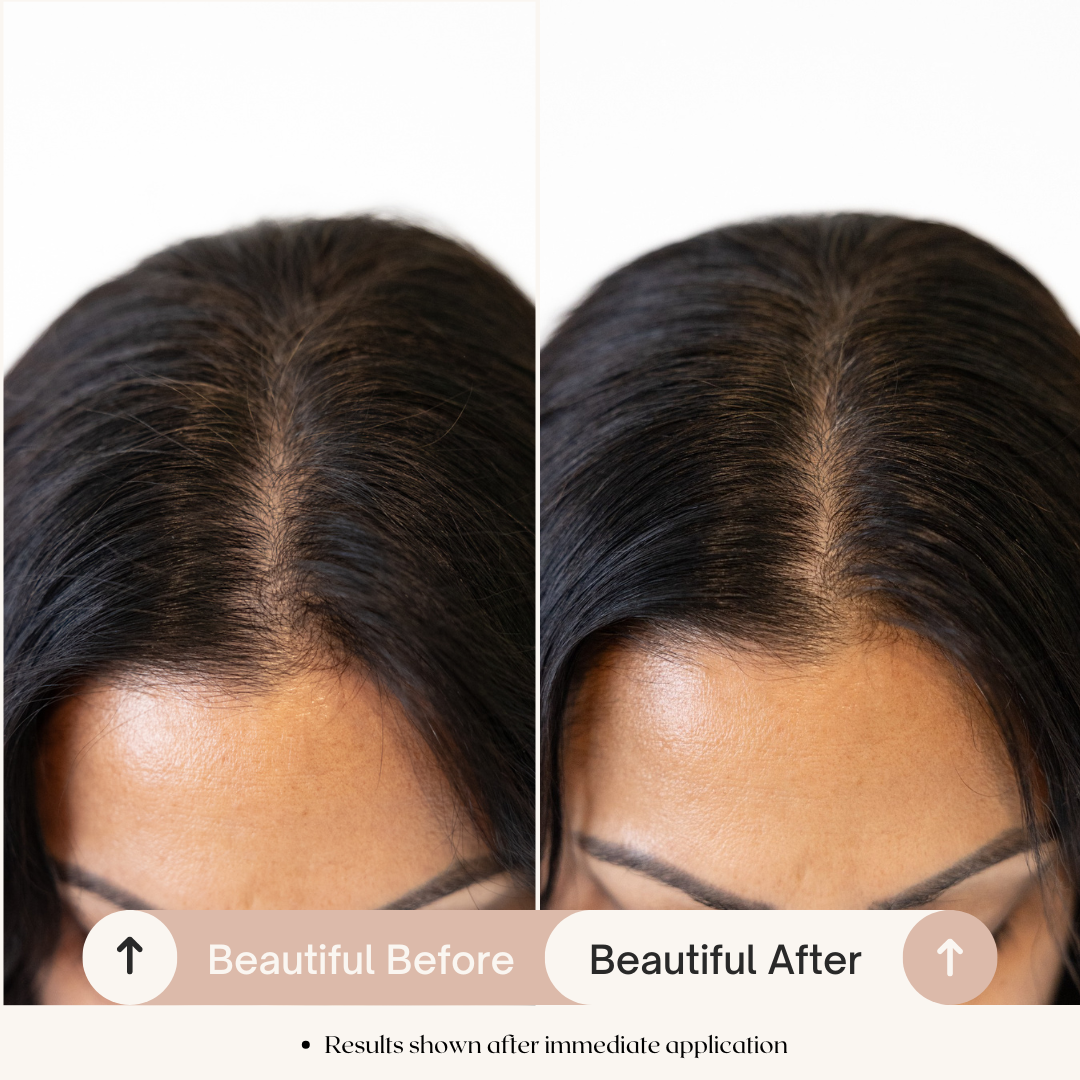 Before and after comparison of Glow Jar Beauty Scalp Serum application on a person's head.