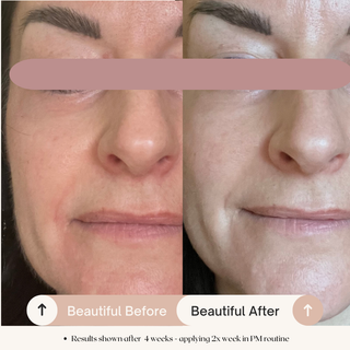 7.6% AHA Leave On Exfoliant