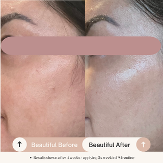 7.6% AHA Leave On Exfoliant