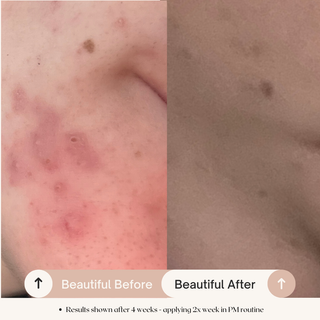 7.6% AHA Leave On Exfoliant